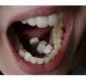  Medical Abortion Pills Comes With Womb Cleaning Pills +27738432716