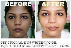 Permanent Skin Lightening Skin Whitening Products +27738432716